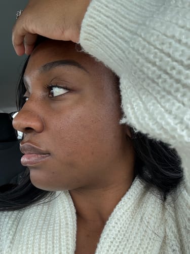 <p><strong>Thousands of Women Who Finally Feel Confident in Their Skin</strong></p>