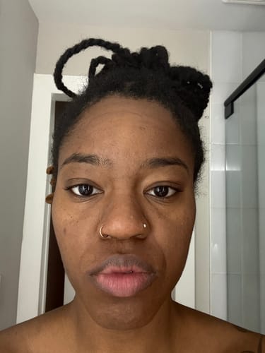 <p><strong>Thousands of Women Who Finally Feel Confident in Their Skin</strong></p>